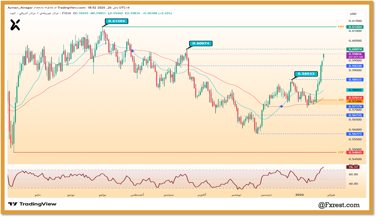 التحليل الفني لزوج الدولار النيوزيلندي مقابل الدولار الأمريكي (NZD/USD)